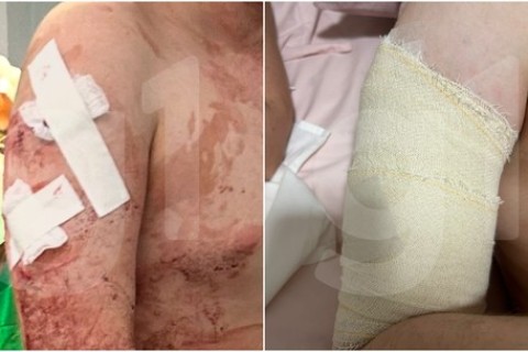 Estudante ferido em ataque em escola no Ceará sofreu 30 pontos pelo corpo e recebeu alta após cirurgia