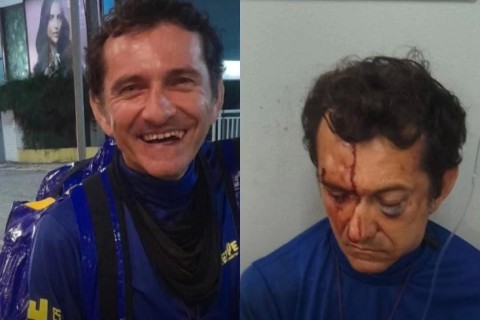 Entregador agredido por cliente deve passar por cirurgia no rosto; vaquinha é criada para ajudá-lo