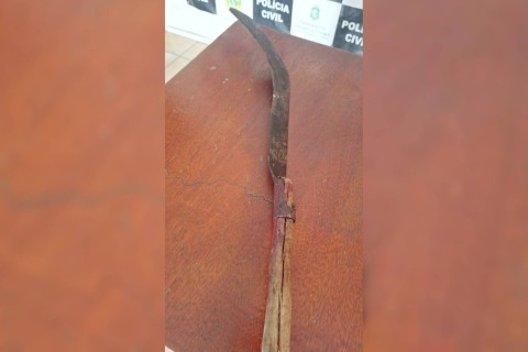 Vizinho decepa mão do outro com foice durante briga no interior do Ceará, diz família
