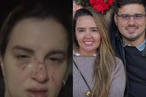 Irmã do vereador mais votado de Maranguape relata ter sido agredida no rosto por cunhada