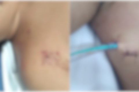 Polícia prende suspeito de perfurar adolescente grávida com chave de fenda, em Quixeramobim-CE