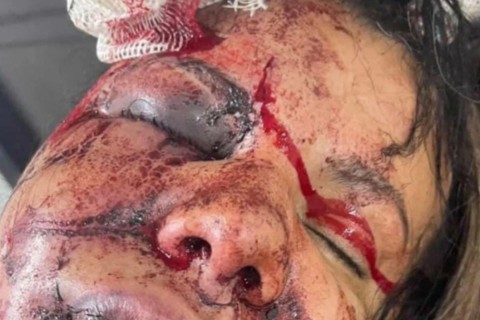 Mulher é agredida pelo namorado dentro do elevador em um condomínio