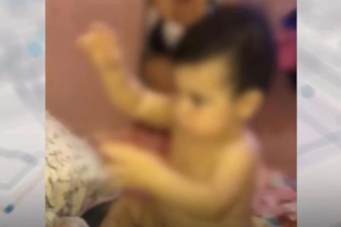 Criança fica com sequelas da covid-19