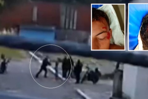 MP cobra que estado indenize jovem autista agredido por policiais com pancada na cabeça